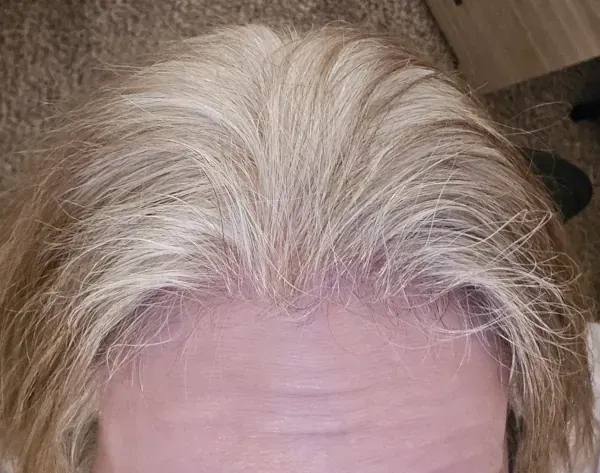 The top of my head showing my gray hair growth.